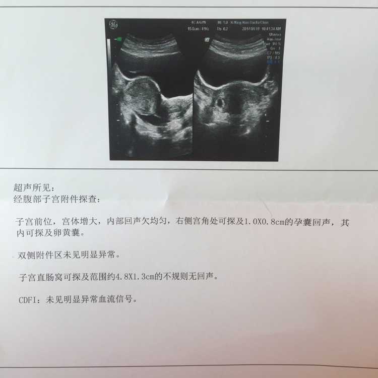 2024年广东省供卵试管助孕医院排名汇总，内附试管成功率及供卵现状